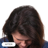 Capillus Plus Laser Therapy Cap For Hair Regrowth Prevents Hair Loss NEW