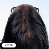Capillus Plus Laser Therapy Cap For Hair Regrowth Prevents Hair Loss NEW