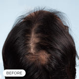 Capillus Plus Laser Therapy Cap For Hair Regrowth Prevents Hair Loss NEW