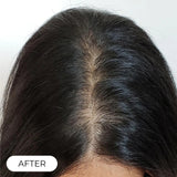 Capillus ONE S Laser Therapy Cap For Hair Regrowth Prevents Hair Loss NEW