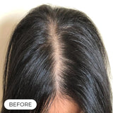 Capillus ONE S Laser Therapy Cap For Hair Regrowth Prevents Hair Loss NEW