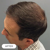Capillus ONE S Laser Therapy Cap For Hair Regrowth Prevents Hair Loss NEW