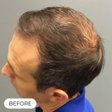 Capillus ONE S Laser Therapy Cap For Hair Regrowth Prevents Hair Loss NEW