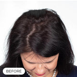 Capillus Plus Laser Therapy Cap For Hair Regrowth Prevents Hair Loss NEW